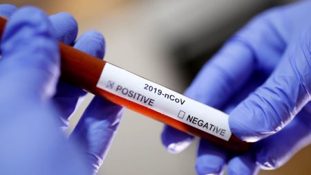 Azərbaycanda 3 televiziya işçisində koronavirus aşkarlandı