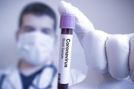 Azərbaycanda koronavirusa yoluxanların sayı 13 mini ötdü