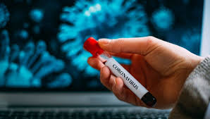 Rusiyada daha 6791 nəfər koronavirusa yoluxub, 104 nəfər ölüb