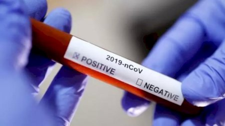 Ermənistanda bir gündə 697 nəfərdə koronavirus aşkarlandı 