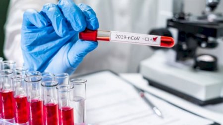 Azərbaycanda 336 nəfərdə koronavirus aşkarlandı, 5 nəfər öldü