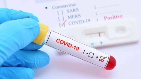 Bu əlamətlərdən biri varsa, təcili COVİD-19 analizi verin