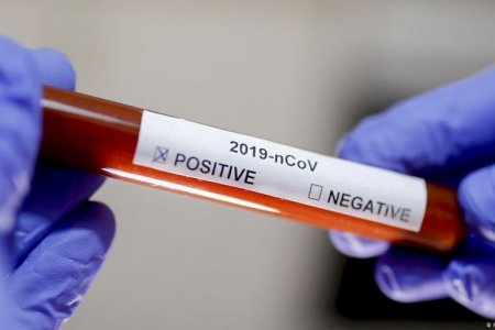 Azərbaycanda indiyədək 449 235 koronavirus testi aparılıb