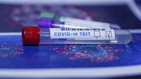 Azərbaycanda bir gündə 513 nəfər COVID-19-a yoluxdu, 8 nəfər vəfat etdi