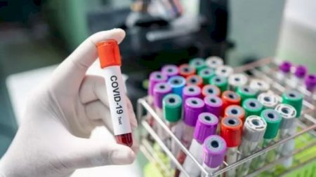 Naxçıvanda koronavirusa yoluxma qeydə alınmadı - Son statistika