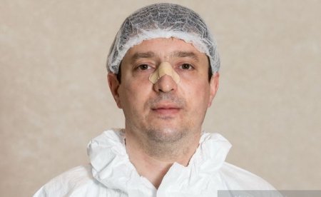 Pandemiya xəstəxanasının həkimi: “Ölkədə COVID-19-un real daşıyıcılarının sayı üç-beş dəfə çoxdur”