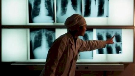 Koronavirusdan sonra HİV və malyariya dünyanı təhdid edir