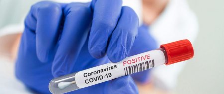 Ermənistanda koronavirusdan ölənlərin sayı artdı 