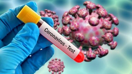Azərbaycanda daha 129 nəfərdə koronavirus aşkarlandı - 4 nəfər öldü 