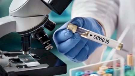 Seroloji testlər bu yaş qruplarındakı şəxslərdən götürüləcək - TƏBİB-dən AÇIQLAMA