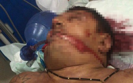 “Lotu Quli” güllələndikdən sonra - Fotolar