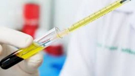 Seroloji testlər hansı faydanı verəcək? - İnfeksionist 