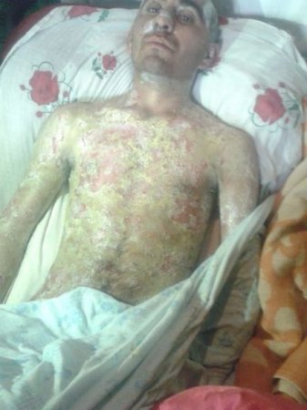 Şikayətçi vətəndaş: “Həkimlər deyir sənə pensiya düşmür” - FOTO