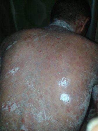 Şikayətçi vətəndaş: “Həkimlər deyir sənə pensiya düşmür” - FOTO