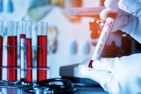 Azərbaycanda daha 139 nəfər koronavirusa yoluxub, 128 nəfər sağalıb, 1 nəfər ölüb