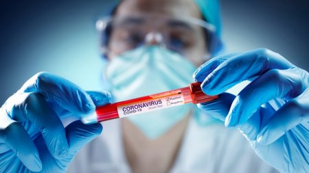 Rusiyadan Azərbaycana gələn 33 nəfərdə COVID-19 aşkarlandı (RƏSMİ)