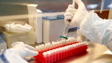 Ermənistanda 920 nəfər koronavirusdan öldü