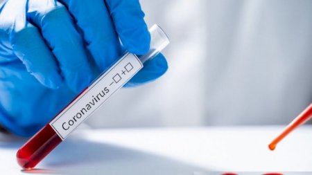 Yoluxanların sayı yenidən 100-ü keçdi, 1 nəfər vəfat etdi