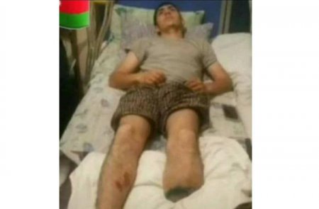 Qazaxın icra başçısından Vətən müharibəsi qazisinə sayğısızlıq — FOTO 