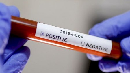 Rusiyada son sutkada 26 513 nəfər koronavirusa yoluxub