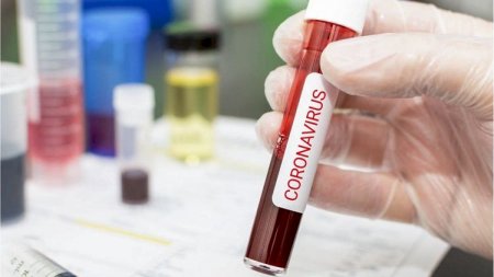 Gürcüstanda son sutkada 38 nəfər koronavirusdan ölüb