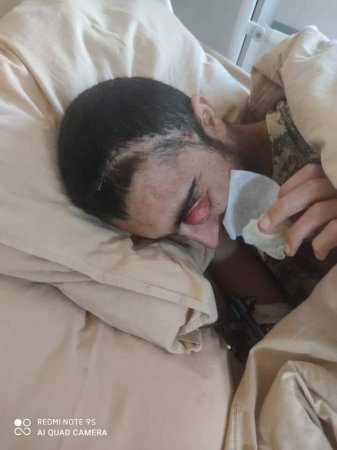 Ağır yaralı olan qazimizin atası: “Savadsızam, sözümü deyə bilmirəm...”