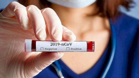 Gürcüstanda koronavirusdan ölənlərin sayı 2 800-ü ötüb