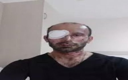 "Masallı İcra Hakimiyyətindən bir dəfə də qapımı açmayıblar" - Vətən müharibəsində gözünü itirən qazi... 