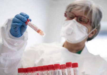 Azərbaycanda indiyədək 2602884 koronavirus testi aparılıb