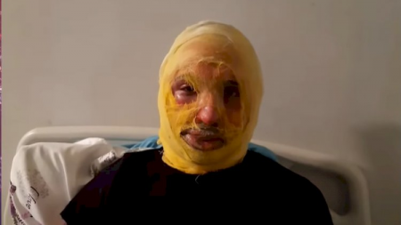 Bərdədə qız görüşdüyü oğlanı niyə yandırıb? – Oğlanın anası danışdı + VİDEO