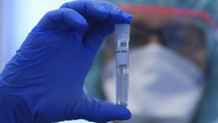 Koronavirusa yoluxanların sayı 600-ü keçdi - Rəqəmlər sürətlə artır