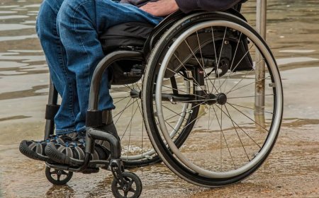 Geridönməz halları olan uşaqlara əlillik müddətsiz təyin ediləcək