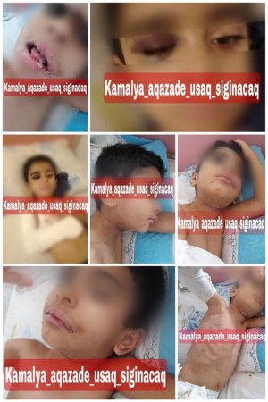 Beş yaşlı uşağa işgəncə verən ana və tanışının görüntüləri - FOTO