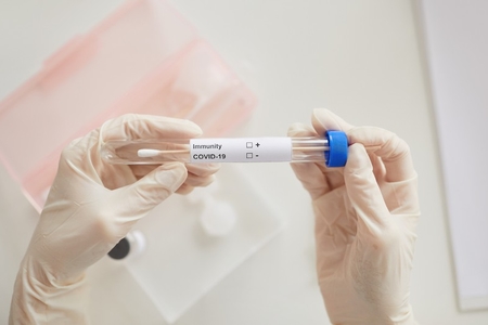 Azərbaycanda daha iki universitetdə tələbələr koronavirusa yoluxdu, 14 qrup bağlandı