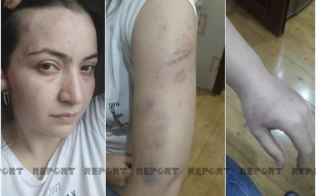 Arvadını öldürən polisin övladlarının kimin qəyyumluğuna veriləcəyi məlum olub