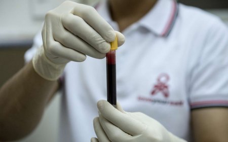 Azərbaycanda indiyədək 7552 İİV xəstəsi qeydiyyata alınıb