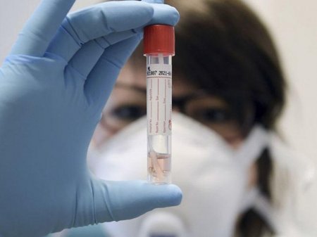 Gürcüstanda daha 74 nəfər COVID-19-dan ölüb