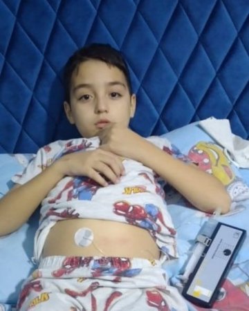 9 yaşlı Hüseyn talassemiyadan əziyyət çəkir: Köməyinizə ehtiyacı var - FOTO