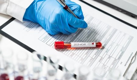 Azərbaycanda son sutkada 6 nəfər koronavirusa yoluxub, ölən olmayıb