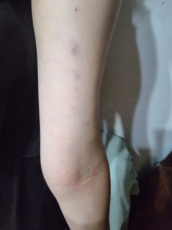 Lənkəranda başçının qadın müavinindən şagirdə qarşı ŞOK ÖZBAŞINALIQ - FOTOFAKT 