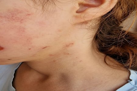 Lənkəranda başçının qadın müavinindən şagirdə qarşı ŞOK ÖZBAŞINALIQ - FOTOFAKT 