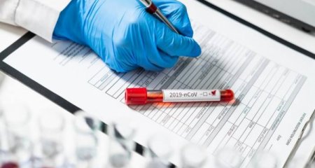 Azərbaycanda son sutkada 29 nəfər koronavirusa yoluxub