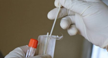 Bakıda özəl klinikalarda meymunçiçəyi testlərinə başlanılır