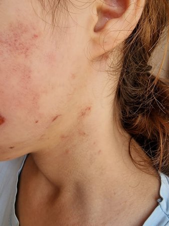 Lənkəranda başçının qadın müavinindən şagirdə qarşı ŞOK ÖZBAŞINALIQ - FOTOFAKT 