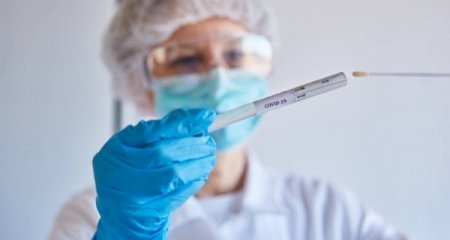 Azərbaycanda son sutkada 437 nəfər koronavirusa yoluxub, 8 nəfər ölüb